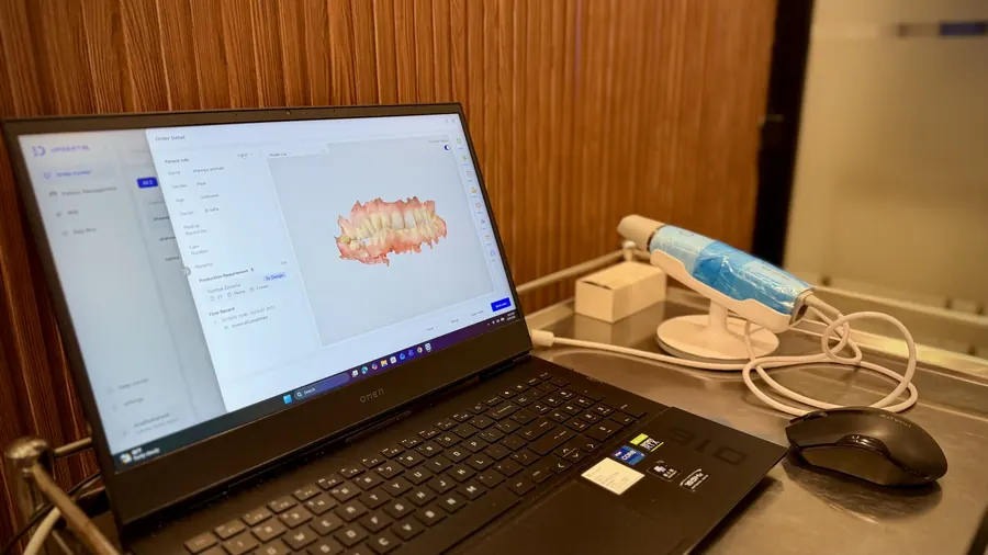 Intraoral scanner showing a 3D scan